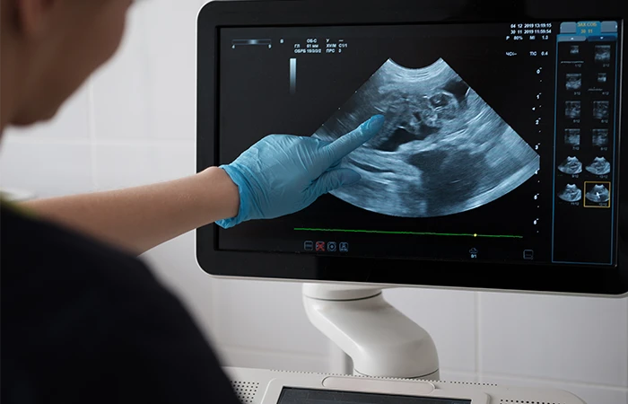 a sonographer points at a screen